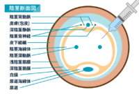 陰茎断面図イラスト