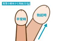 陰茎の根元から湾曲（左右）