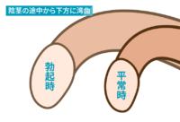 陰茎の途中から下方に湾曲