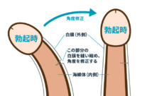 施術方法イメージ